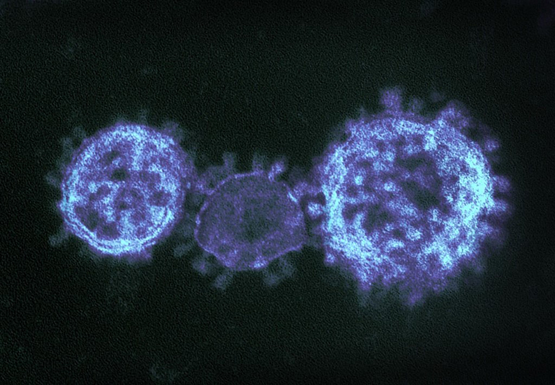 image of Coronaviruses