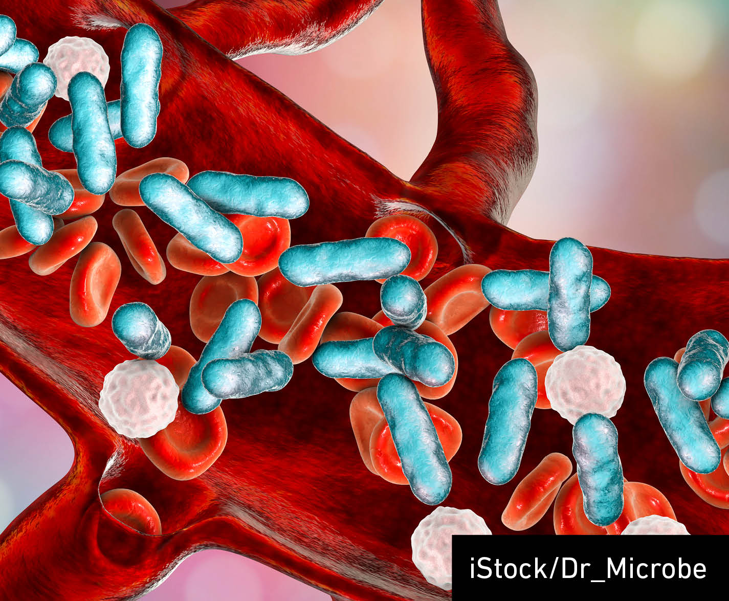 Sepsis, bacteria in blood. 3D illustration showing rod-shaped bacteria with red blood cells and leukocytes
