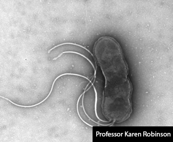 Black and white image of Helicobacter pylori.